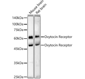 Western Blot - Anti-Oxytocin Receptor Antibody (A309155) - Antibodies.com