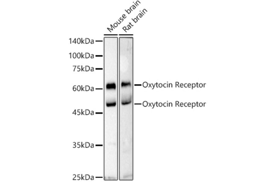 Western Blot - Anti-Oxytocin Receptor Antibody (A309155) - Antibodies.com