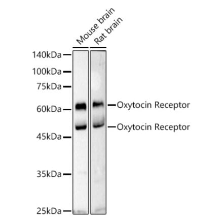 Western Blot - Anti-Oxytocin Receptor Antibody (A309155) - Antibodies.com