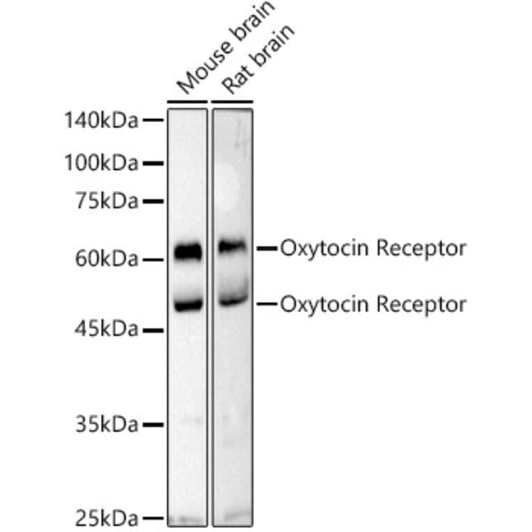 Anti Oxytocin Receptor Antikörper A309155