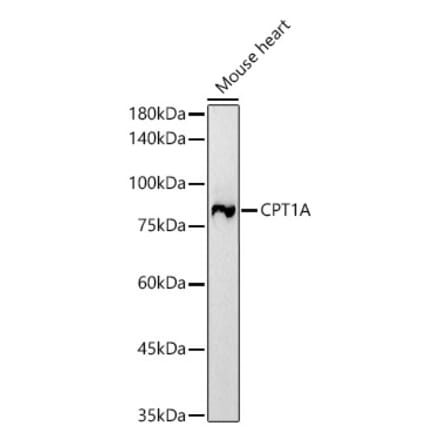 Western Blot - Anti-CPT1A Antibody [ARC51171] (A309158) - Antibodies.com