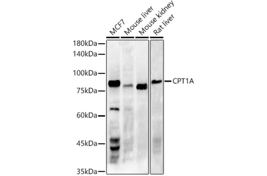 Western Blot - Anti-CPT1A Antibody [ARC51171] (A309158) - Antibodies.com
