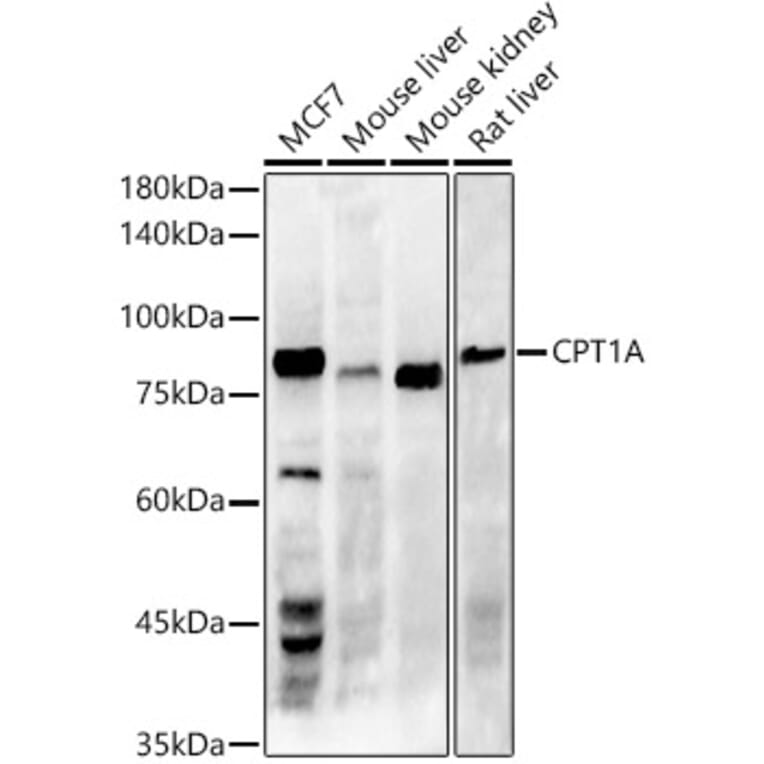 Western Blot - Anti-CPT1A Antibody [ARC51171] (A309158) - Antibodies.com