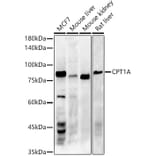Western Blot - Anti-CPT1A Antibody [ARC51171] (A309158) - Antibodies.com