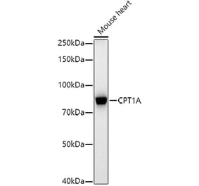 Western Blot - Anti-CPT1A Antibody [ARC51170] (A309159) - Antibodies.com