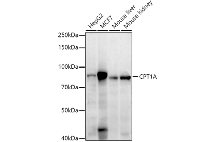 Western Blot - Anti-CPT1A Antibody [ARC51170] (A309159) - Antibodies.com