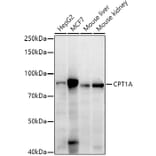 Western Blot - Anti-CPT1A Antibody [ARC51170] (A309159) - Antibodies.com