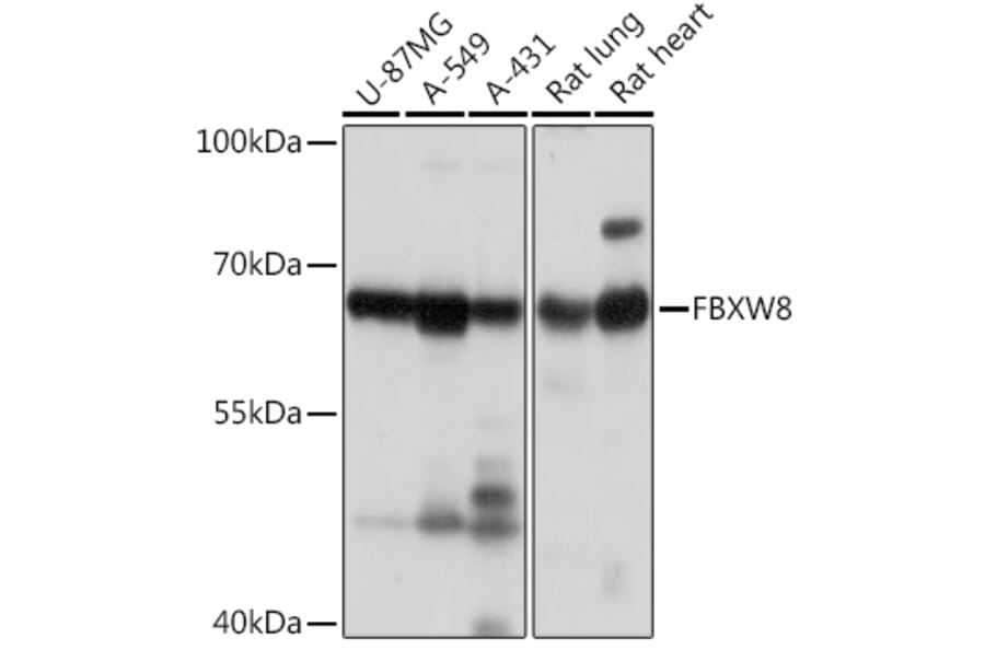 Western Blot - Anti-FBXW8 Antibody (A309160) - Antibodies.com