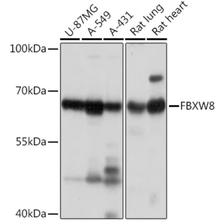 Western Blot - Anti-FBXW8 Antibody (A309160) - Antibodies.com