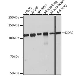 Western Blot - Anti-DDR2 Antibody [ARC0958] (A309162) - Antibodies.com