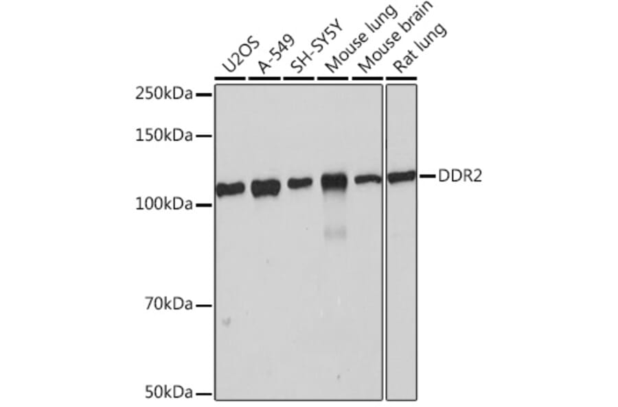 Western Blot - Anti-DDR2 Antibody [ARC0958] (A309162) - Antibodies.com