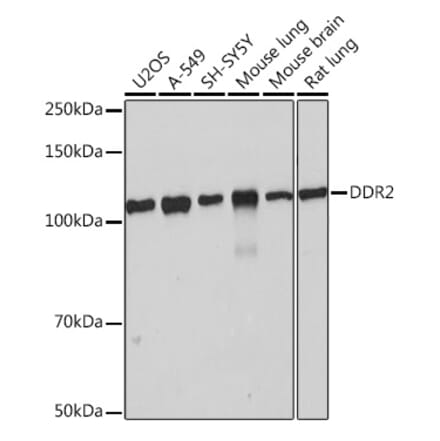 Western Blot - Anti-DDR2 Antibody [ARC0958] (A309162) - Antibodies.com