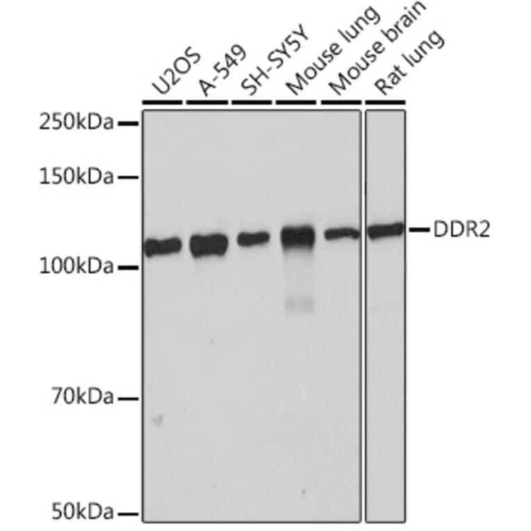 Western Blot - Anti-DDR2 Antibody [ARC0958] (A309162) - Antibodies.com