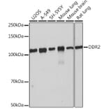 Western Blot - Anti-DDR2 Antibody [ARC0958] (A309162) - Antibodies.com