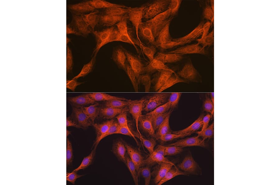 Immunofluorescence - Anti-KAT13D/CLOCK Antibody [ARC1819] (A309164) - Antibodies.com