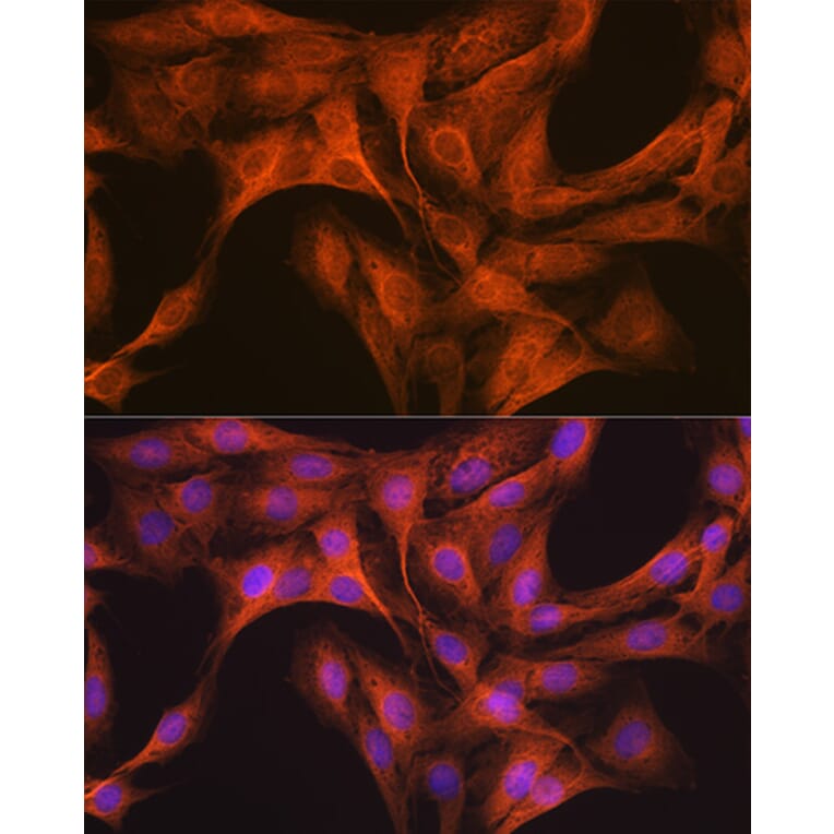 Immunofluorescence - Anti-KAT13D/CLOCK Antibody [ARC1819] (A309164) - Antibodies.com