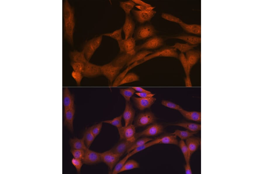 Immunofluorescence - Anti-KAT13D/CLOCK Antibody [ARC1819] (A309164) - Antibodies.com