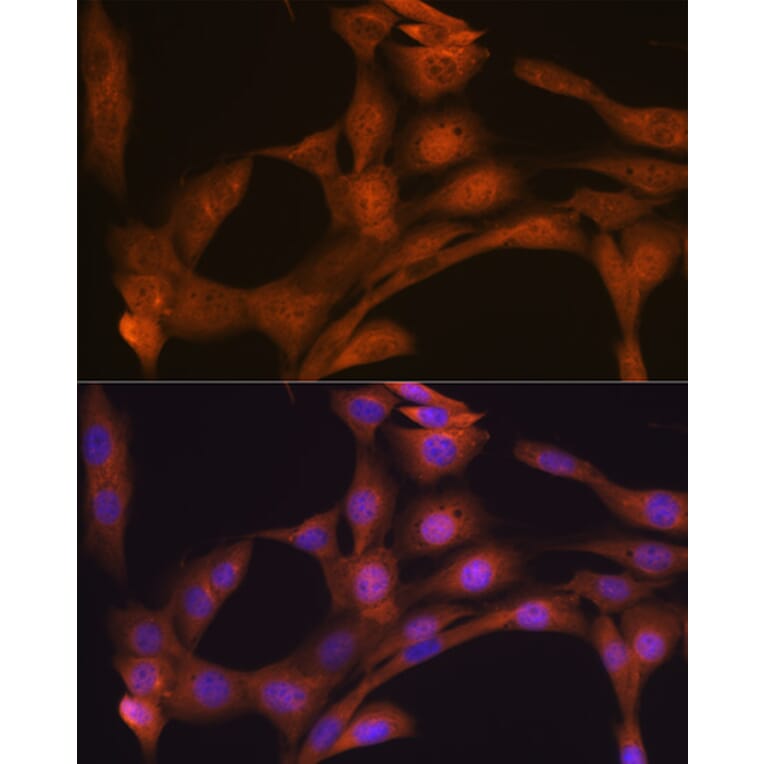 Immunofluorescence - Anti-KAT13D/CLOCK Antibody [ARC1819] (A309164) - Antibodies.com