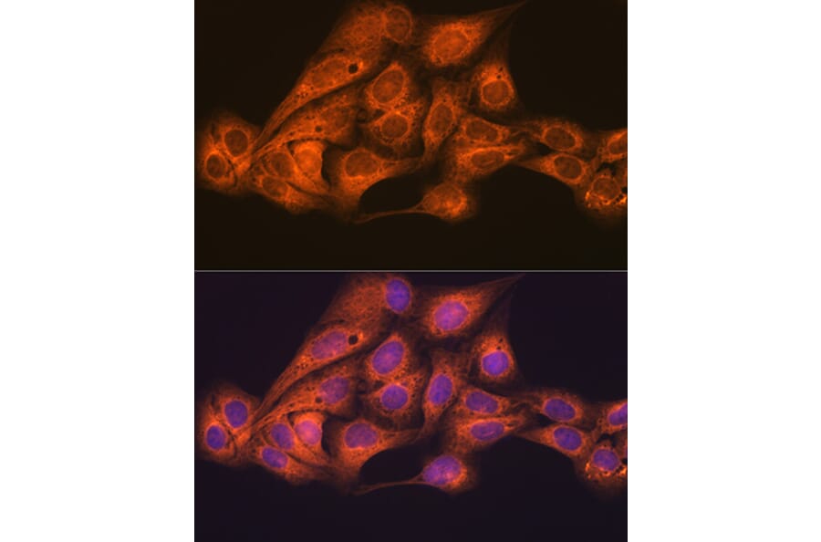Immunofluorescence - Anti-KAT13D/CLOCK Antibody [ARC1819] (A309164) - Antibodies.com