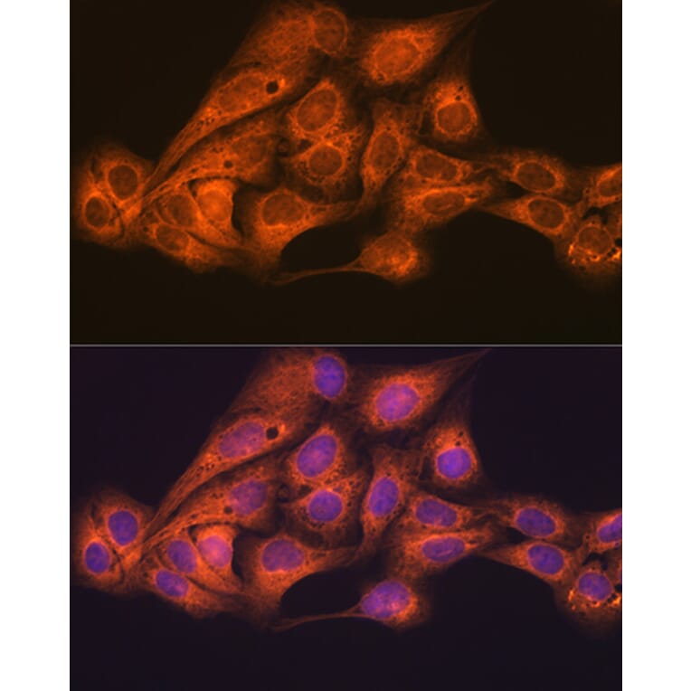 Immunofluorescence - Anti-KAT13D/CLOCK Antibody [ARC1819] (A309164) - Antibodies.com