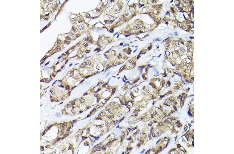 Immunohistochemistry - Anti-Smad1 Antibody (A309166) - Antibodies.com