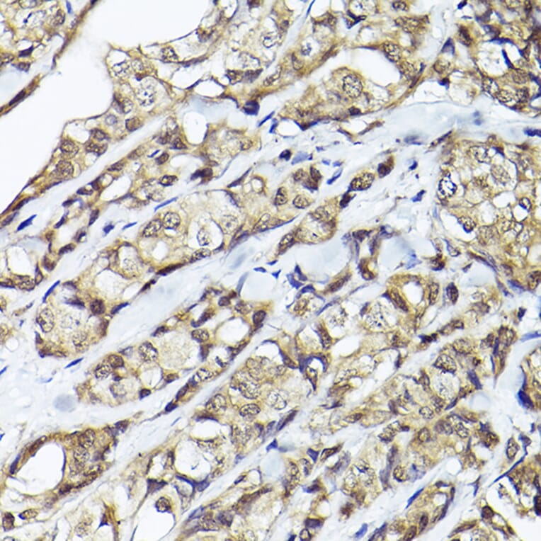 Immunohistochemistry - Anti-Smad1 Antibody (A309166) - Antibodies.com