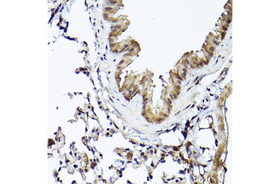 Immunohistochemistry - Anti-Smad1 Antibody (A309166) - Antibodies.com