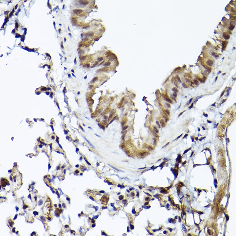 Immunohistochemistry - Anti-Smad1 Antibody (A309166) - Antibodies.com