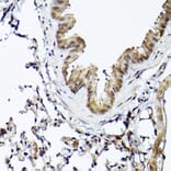 Immunohistochemistry - Anti-Smad1 Antibody (A309166) - Antibodies.com