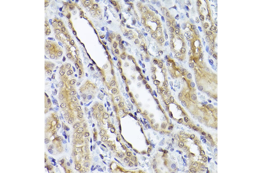 Immunohistochemistry - Anti-Smad1 Antibody (A309166) - Antibodies.com