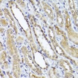 Immunohistochemistry - Anti-Smad1 Antibody (A309166) - Antibodies.com