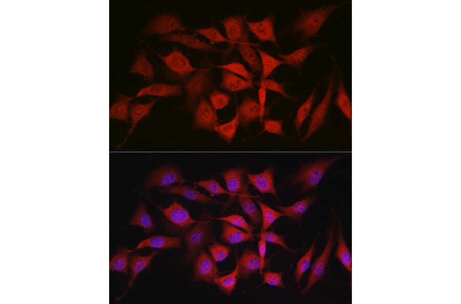 Immunofluorescence - Anti-Smad1 Antibody (A309166) - Antibodies.com