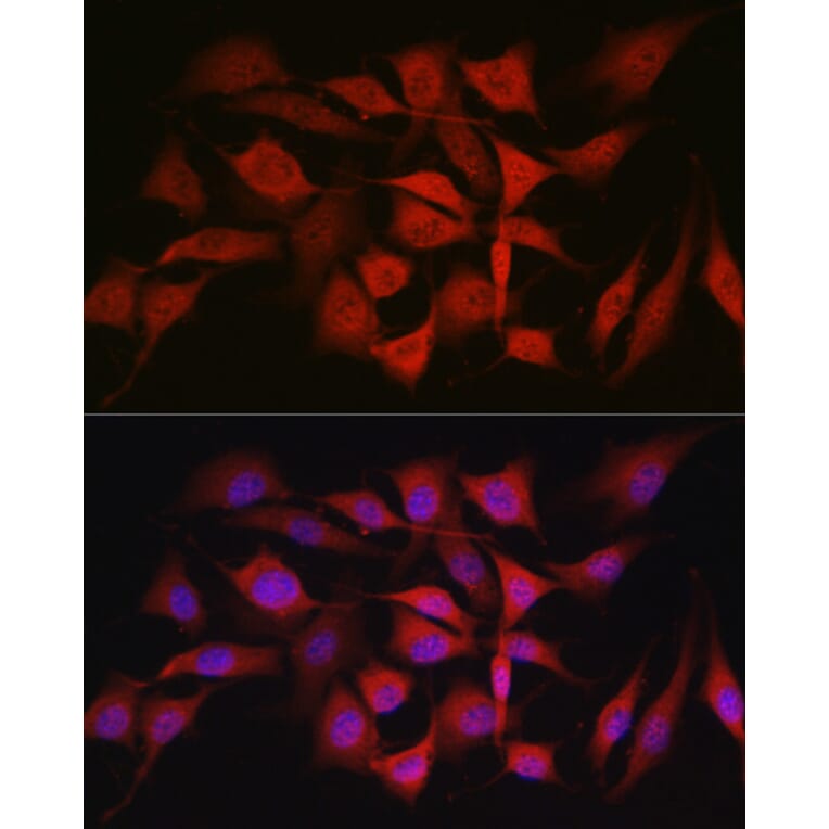 Immunofluorescence - Anti-Smad1 Antibody (A309166) - Antibodies.com