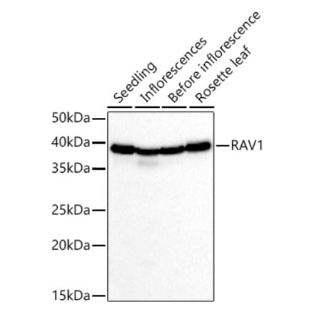 Western Blot - Anti-RAV1 Antibody (A309169) - Antibodies.com