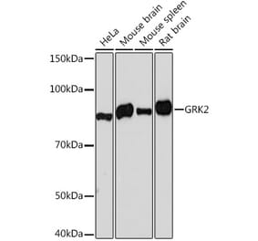 Western Blot - Anti-GRK2 Antibody [ARC1013] (A309171) - Antibodies.com