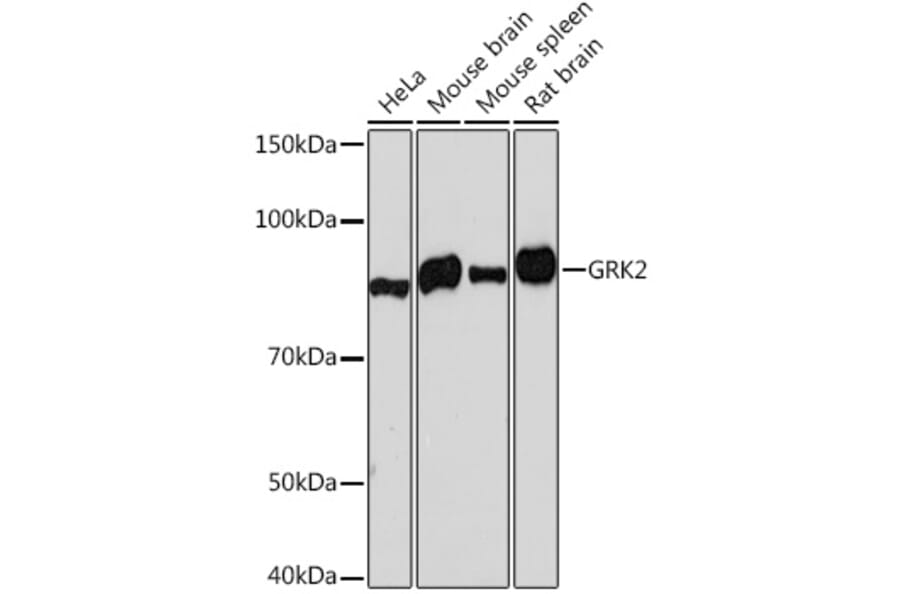 Western Blot - Anti-GRK2 Antibody [ARC1013] (A309171) - Antibodies.com