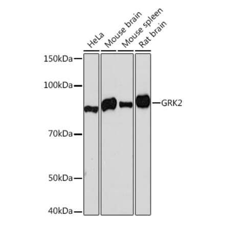 Western Blot - Anti-GRK2 Antibody [ARC1013] (A309171) - Antibodies.com