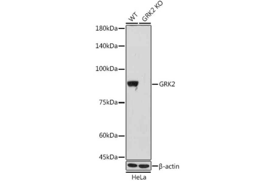 Western Blot - Anti-GRK2 Antibody [ARC1013] (A309171) - Antibodies.com