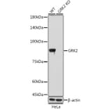 Western Blot - Anti-GRK2 Antibody [ARC1013] (A309171) - Antibodies.com