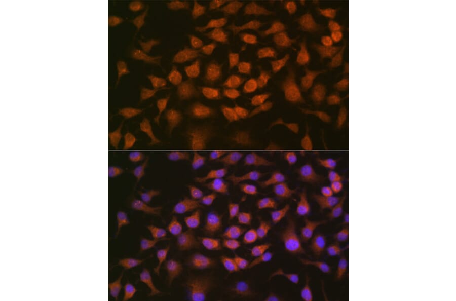 Immunofluorescence - Anti-GRK2 Antibody [ARC1013] (A309171) - Antibodies.com