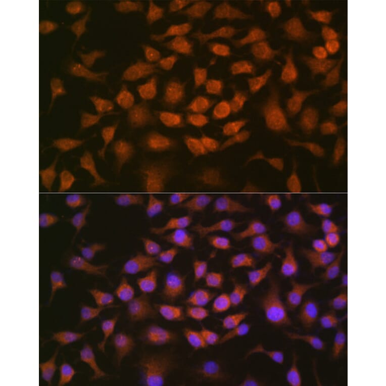 Immunofluorescence - Anti-GRK2 Antibody [ARC1013] (A309171) - Antibodies.com