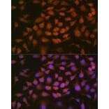 Immunofluorescence - Anti-GRK2 Antibody [ARC1013] (A309171) - Antibodies.com