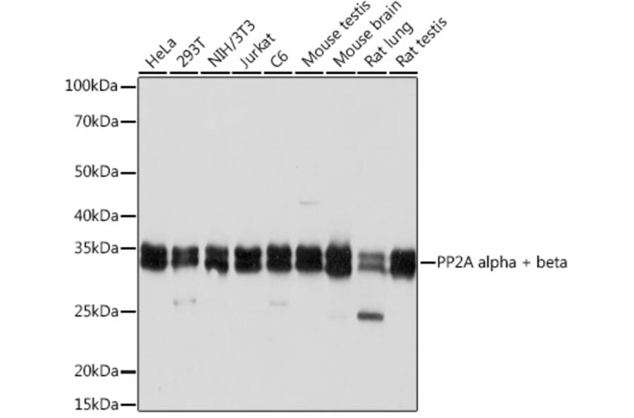 Western Blot - Anti-PP2A-alpha + PPP2CB Antibody [ARC1889] (A309172) - Antibodies.com