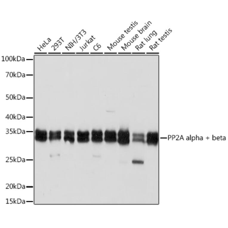 Western Blot - Anti-PP2A-alpha + PPP2CB Antibody [ARC1889] (A309172) - Antibodies.com