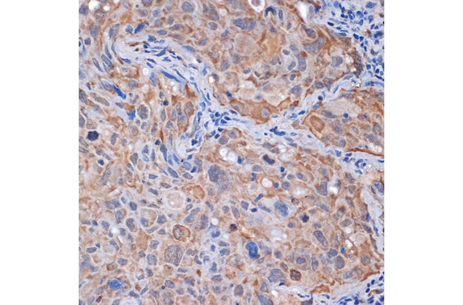 Immunohistochemistry - Anti-PP2A-alpha + PPP2CB Antibody [ARC1889] (A309172) - Antibodies.com