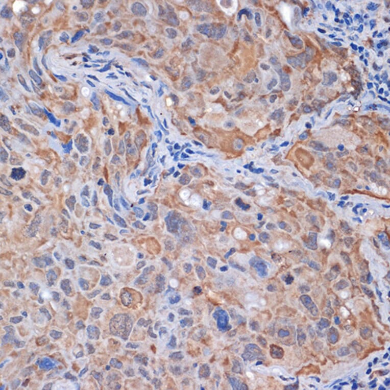 Immunohistochemistry - Anti-PP2A-alpha + PPP2CB Antibody [ARC1889] (A309172) - Antibodies.com