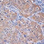 Immunohistochemistry - Anti-PP2A-alpha + PPP2CB Antibody [ARC1889] (A309172) - Antibodies.com