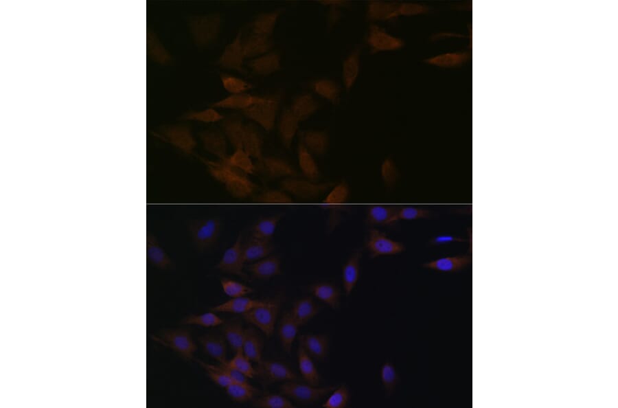 Immunofluorescence - Anti-PP2A-alpha + PPP2CB Antibody [ARC1889] (A309172) - Antibodies.com