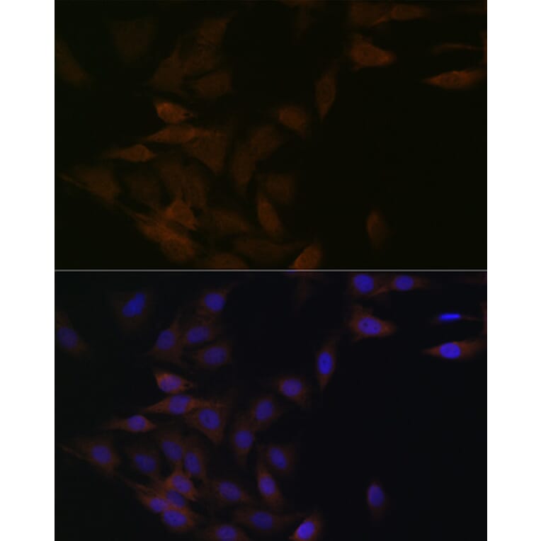 Immunofluorescence - Anti-PP2A-alpha + PPP2CB Antibody [ARC1889] (A309172) - Antibodies.com