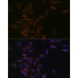 Immunofluorescence - Anti-PP2A-alpha + PPP2CB Antibody [ARC1889] (A309172) - Antibodies.com